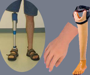 artificial-limbs